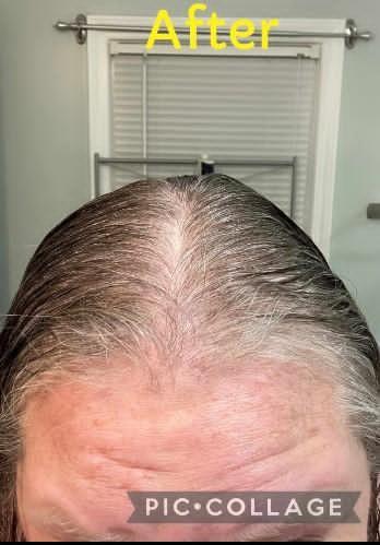 Before transformation